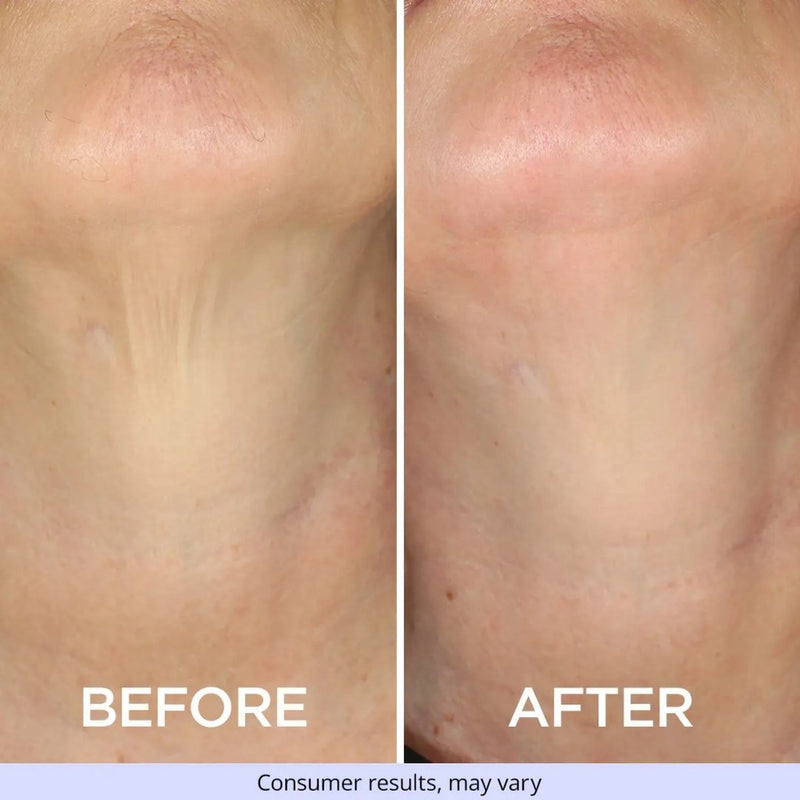 2. Visible Results in 4 Weeks With Consistent Use.