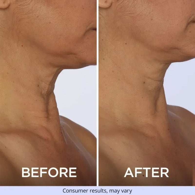 7. It delivers remarkable results for women of all ages